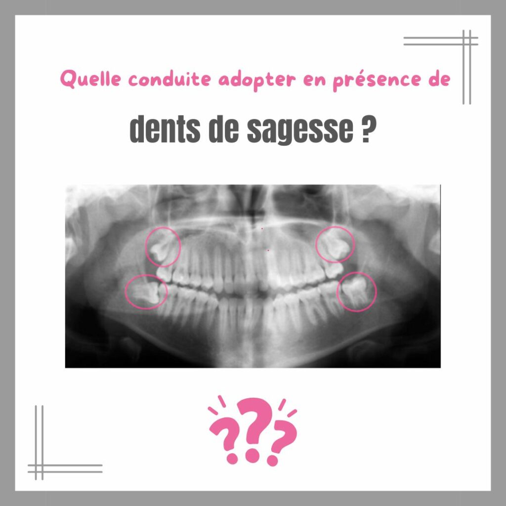 Copie de Gêne, douleurs, sensibilités et appareil dentaire