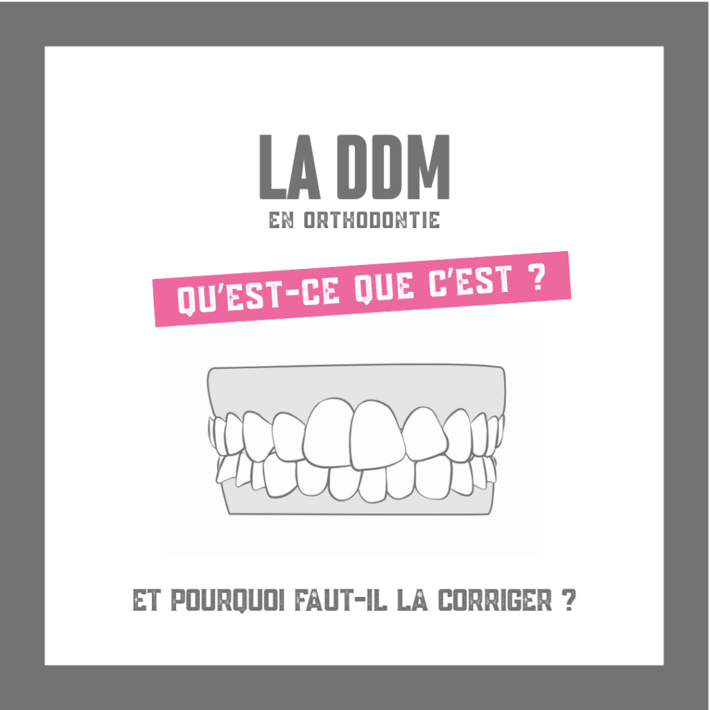 La DDM en orthodontie
