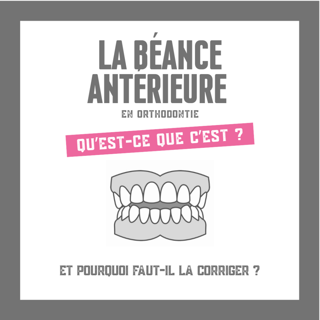 La béance en orthodontie