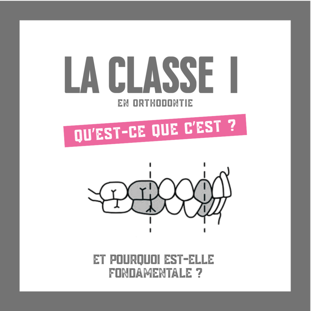 La classe I d’Angle (Publication Instagram)